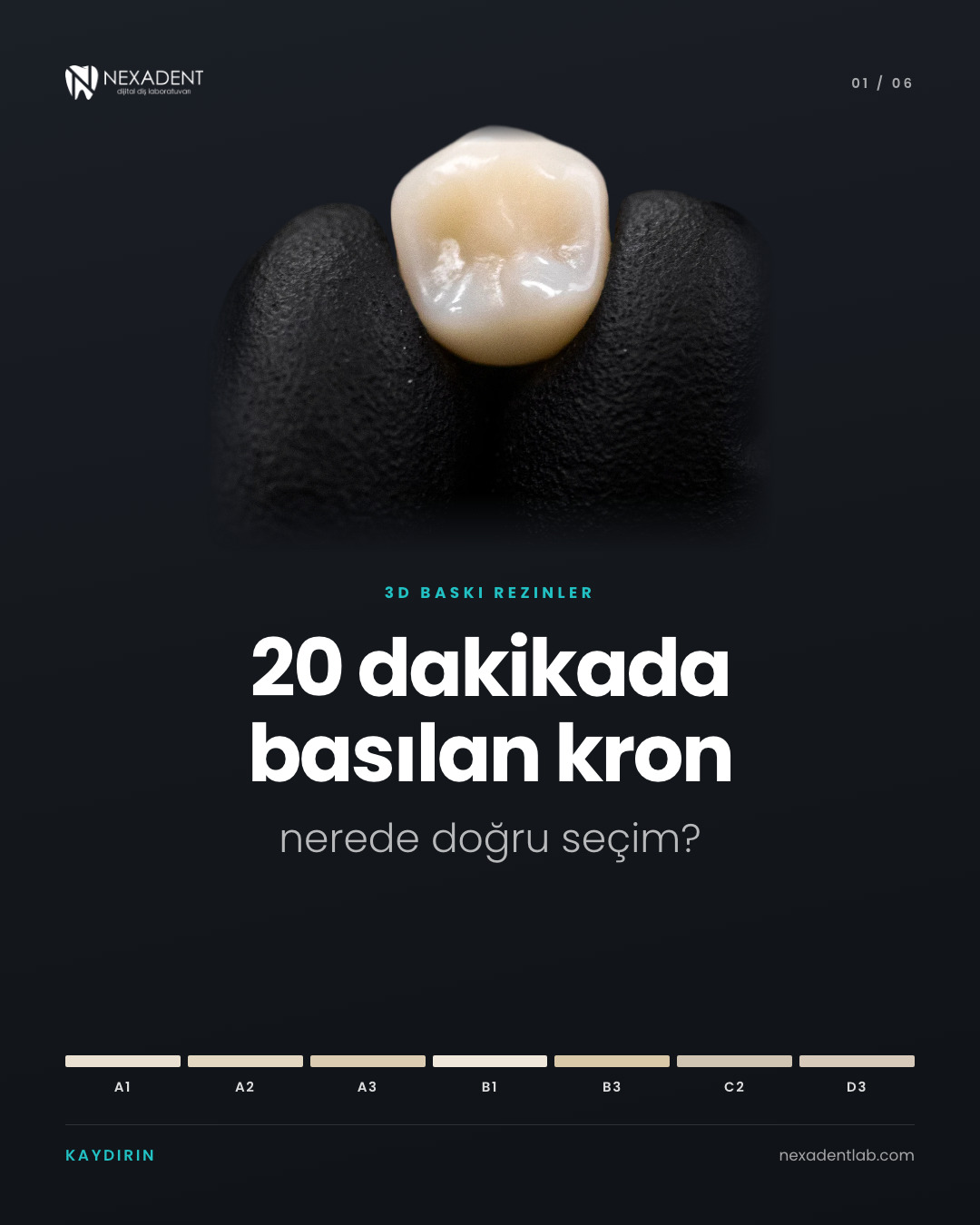 3D yazıcıda basılan seramik dolgulu hibrit rezin kron