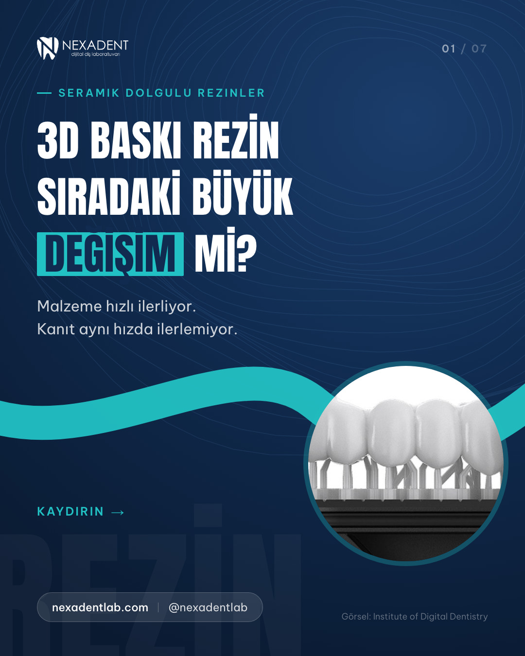 3D baskı rezinler kalıcı restorasyon mu