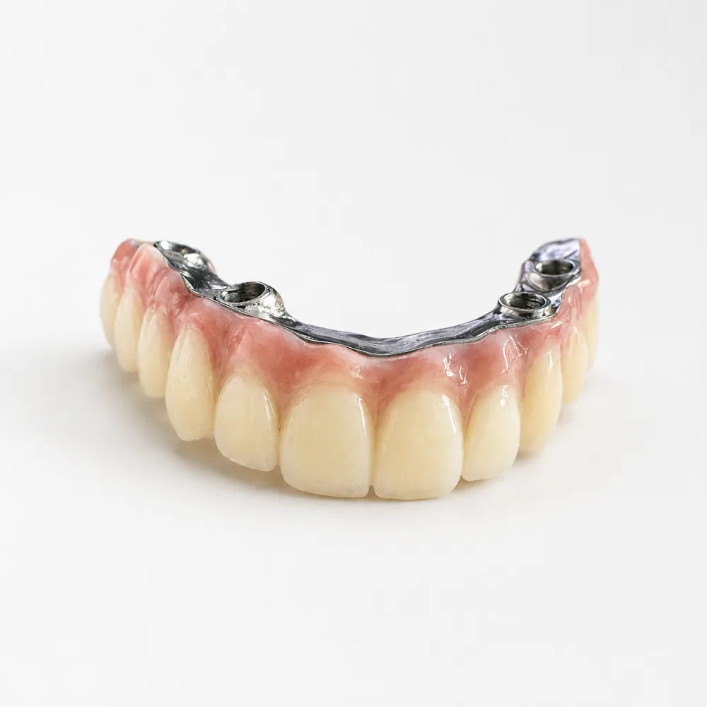 Nexadent — implant üstü geçici PMMA protez